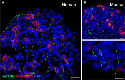 Islet cilia and glucose homeostasis